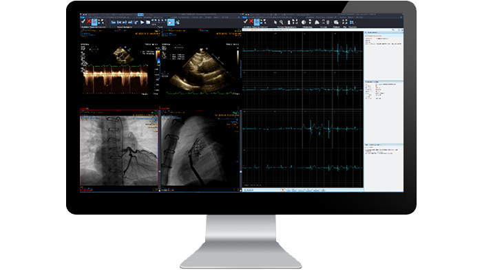 Écran d’interface du module de cardiologie sur un moniteur