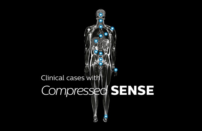 Ordinateur, tablette et téléphone avec cartographie anatomique IRM affichant des cas cliniques de presque toutes les anatomies