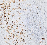 une surface tachetée de blanc et de brun