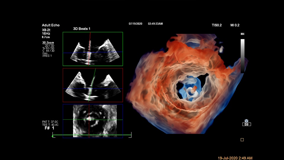 Photo of clinician and patient with spectral-detector CT system