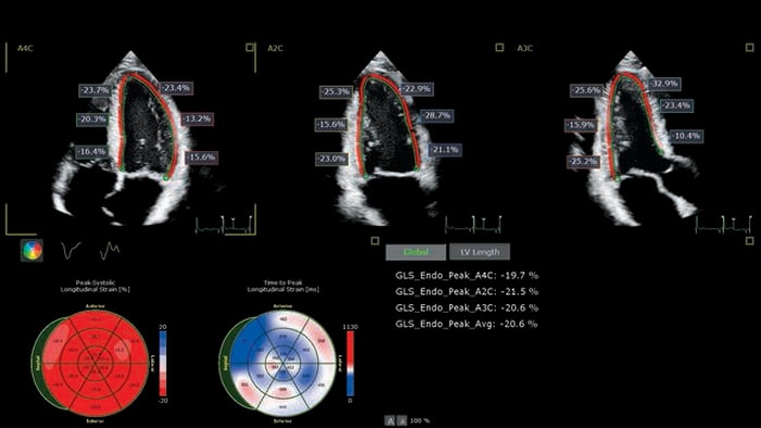 X5 1C Examen d’imagerie AutoStrain