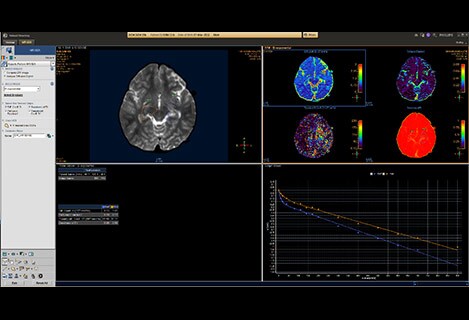 Analyse de diffusion