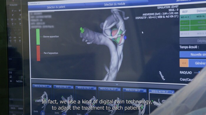 Vidéo sur le système Azurion avec ConnectOS