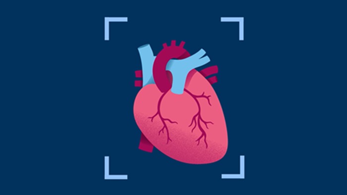 Vidéo cardiaque