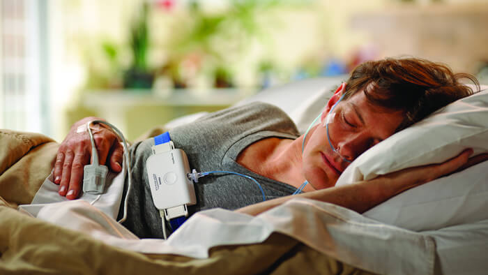 Photographie d’un homme au lit endormi sur le côté et équipé d’un test de sommeil Philips