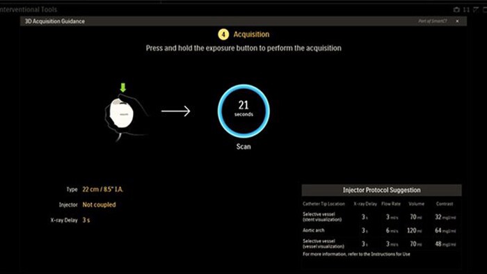 Guide protocole acquisition 3D image procedure interventionnelle IGT smartCT