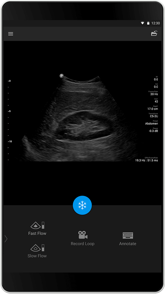 Examen abdominal C5-2