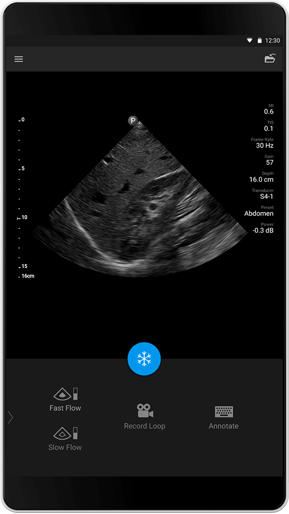 Examen abdominal S4-1