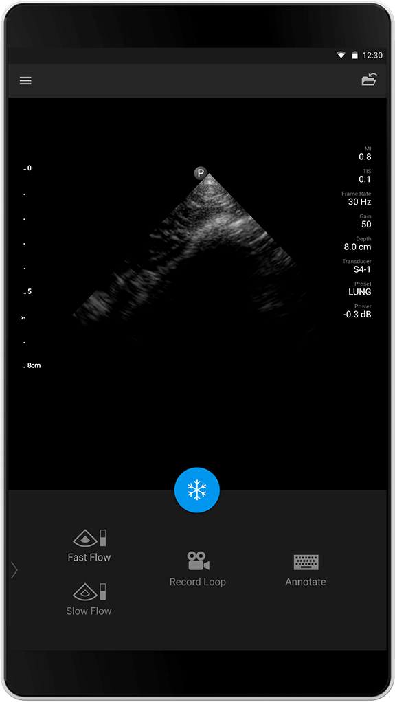 Examen pulmonaire S4-1