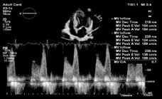 decouvrez image