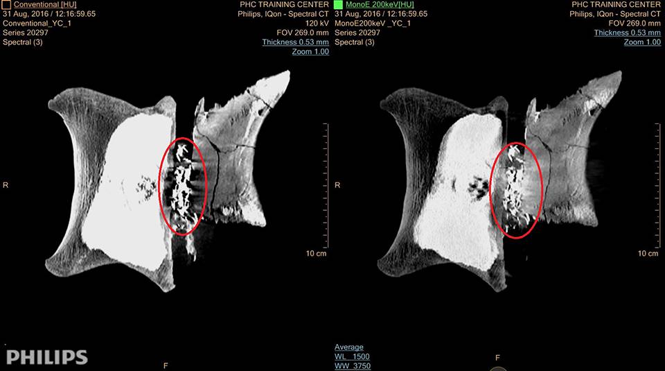 t-rex scan