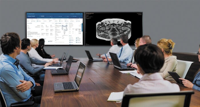 Solutions informatiques pour l'oncologie de précision