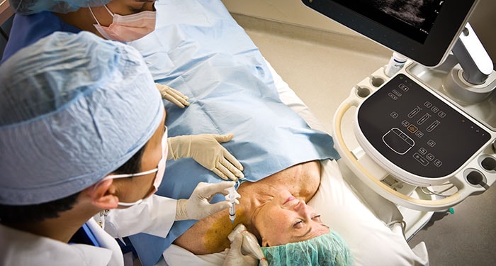 Anesthésie loco-régionale et prise en charge de la douleur