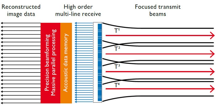 Philips nSIGHT Imaging