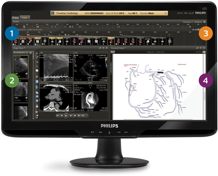un écran d'ordinateur avec une capture d'écran d'un scanner cardiaque