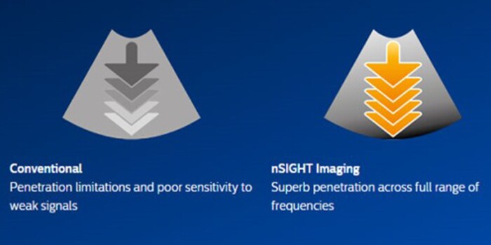 nSIGHT image