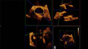 L’ETO 3D temps réel s’affiche en temps réel sur l’écran de l’EchoNavigator