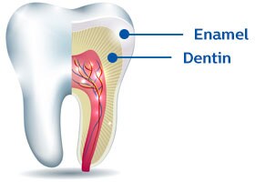 Dents