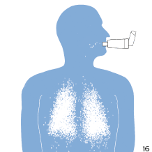 Inhalateur avec chambre