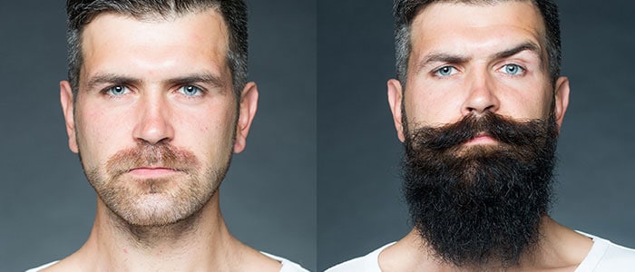 Deux images du même homme sur fond gris : à gauche il a une barbe de 3 jours, à droite il a une barbe complète.