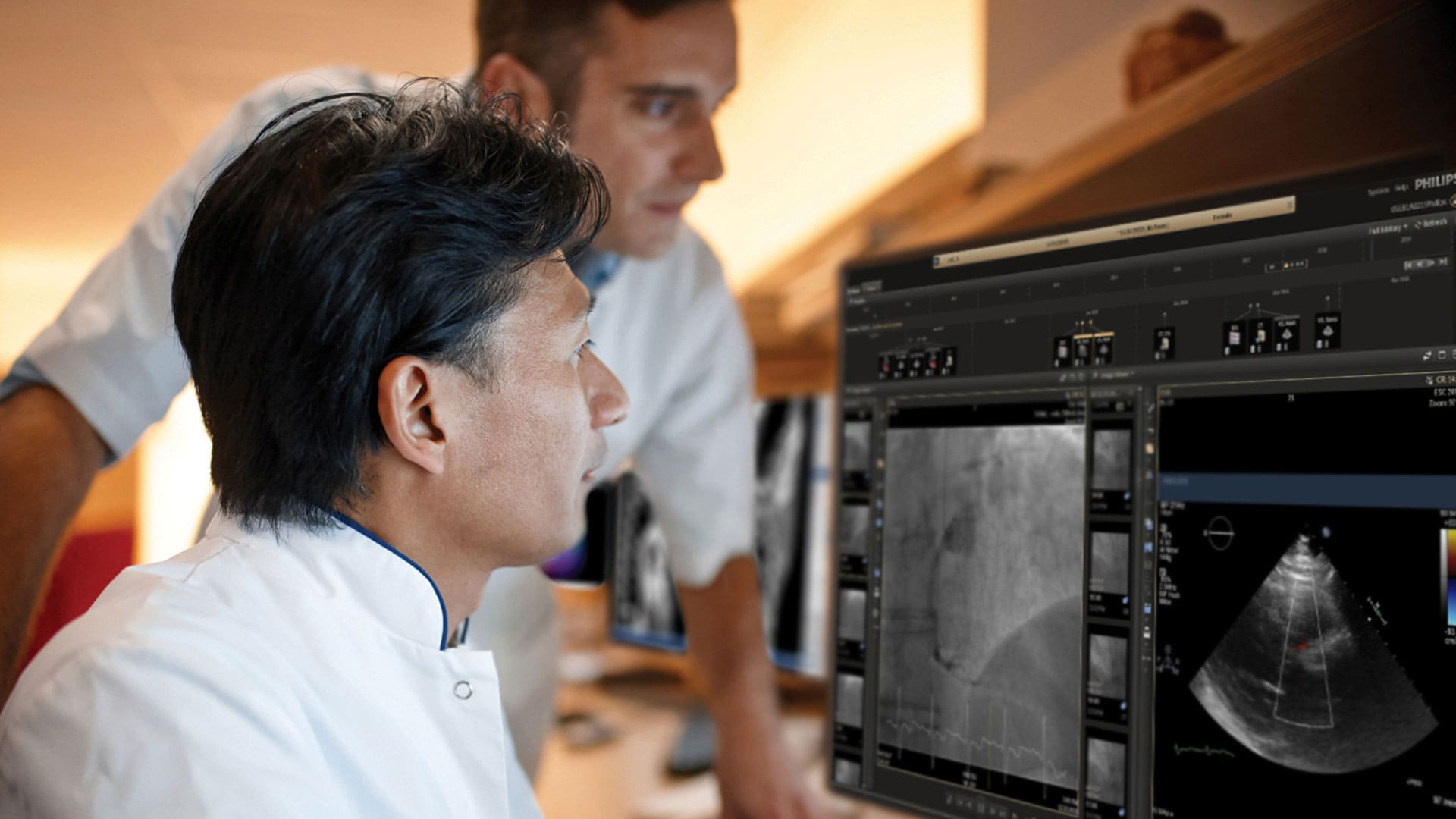 Philips lance la dernière version d'IntelliSpace Cardiovascular, qui comprend désormais des fonctions de reporting pédiatrique étendues et une intégration au système Philips Forcare
