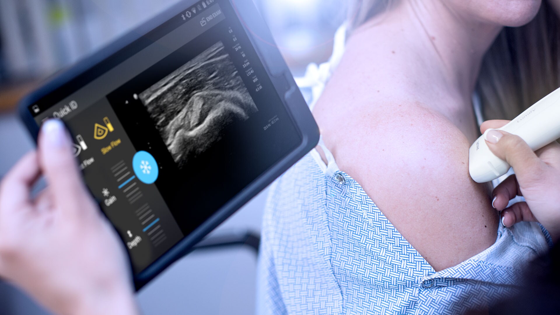 ultra-portable ultrasound scanners