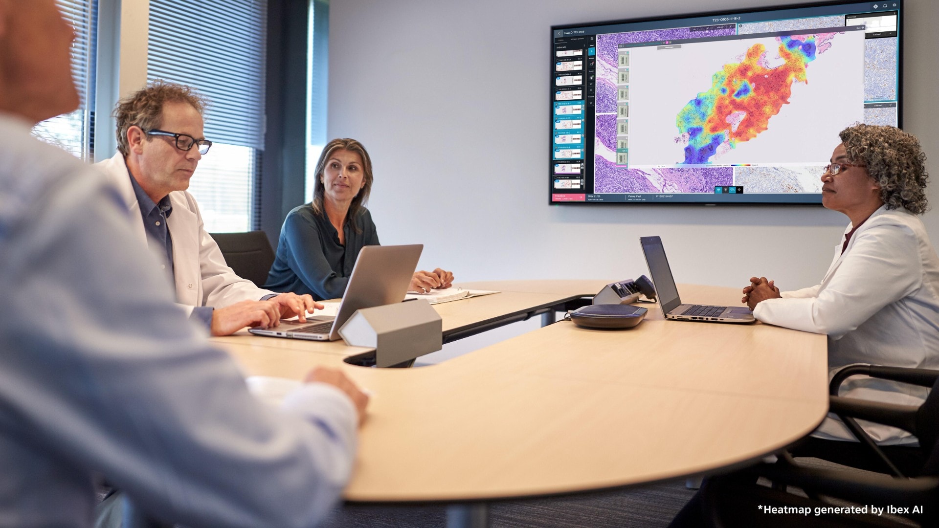 Philips et Ibex renforcent leur partenariat pour des workflows de pathologie plus efficaces et centrés sur le patient