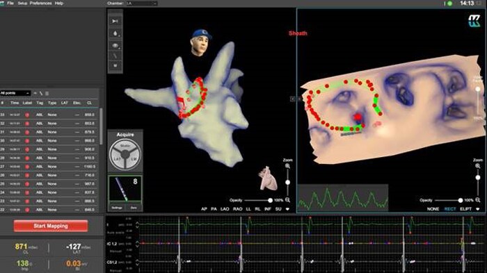 EPD imaging and navigation system for EP