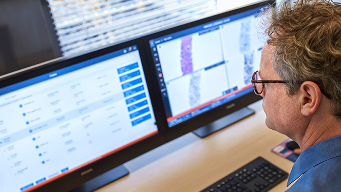 Philips lance une suite de pathologie numérique de nouvelle génération - IntelliSite - pour améliorer la fiabilité du diagnostic et simplifier les flux de travail des laboratoires de pathologie.