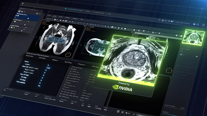 Seeing before scanning: Philips’ predictive preview on the path to autonomous MRI