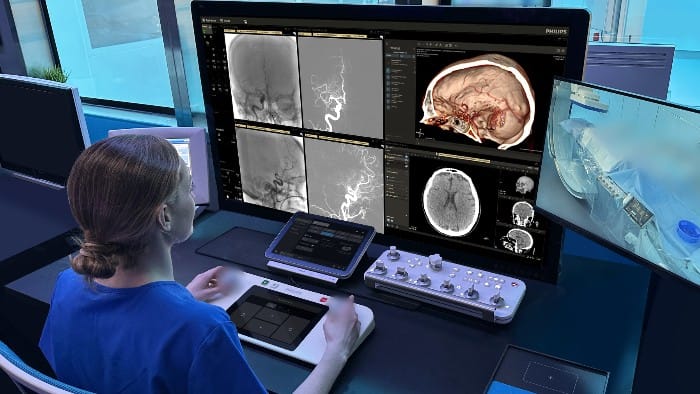 Beyond Robotics: The Next Evolution of Image-Guided Therapy